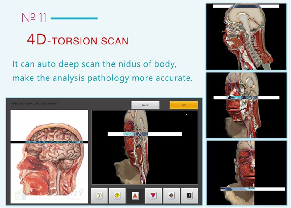 Biophilia 4D Torsion scan showing deep tissue analysis